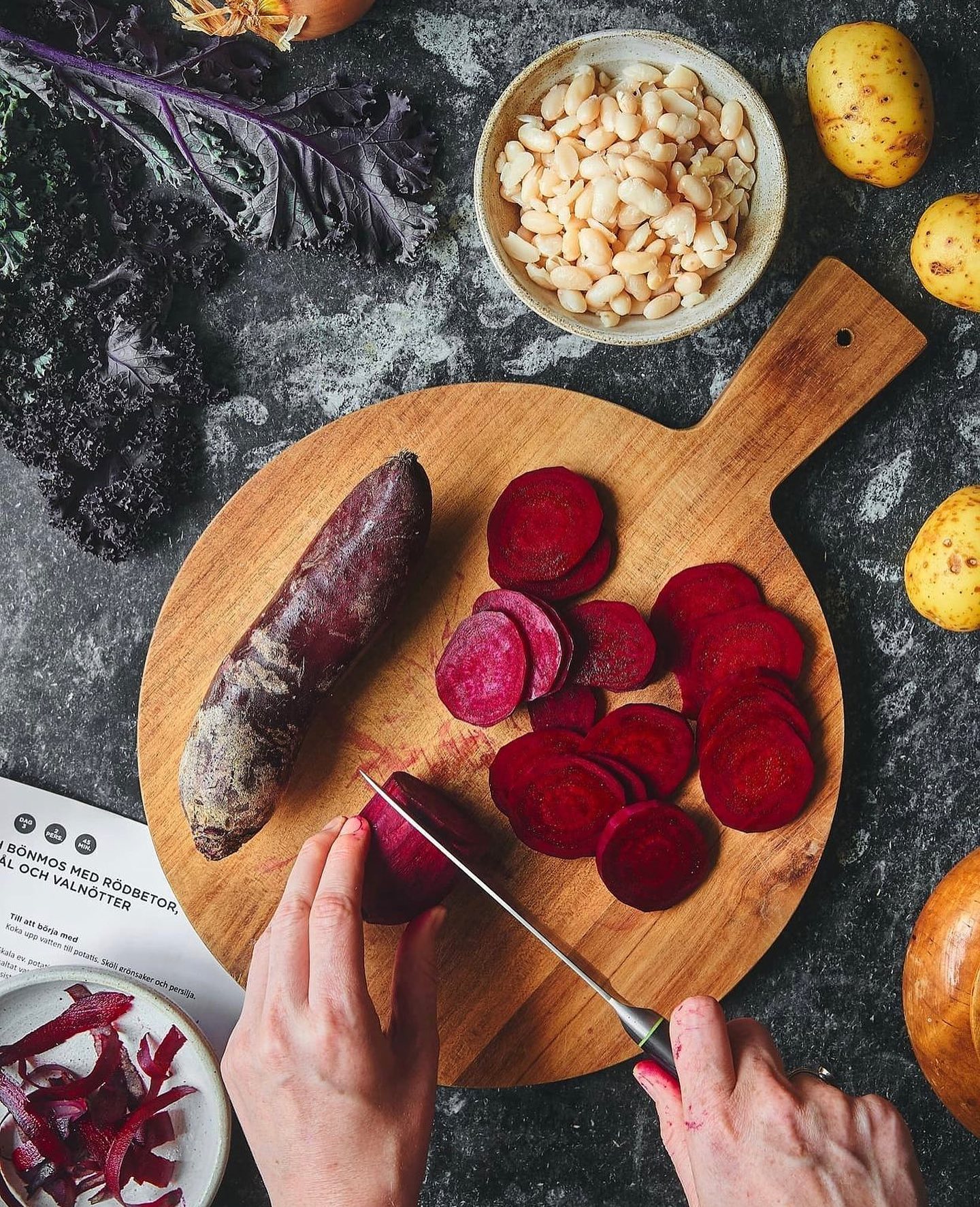 Creamy Potato and Bean Mash with Pickled Beets, Fried Onions, Walnuts, and Crispy Kale